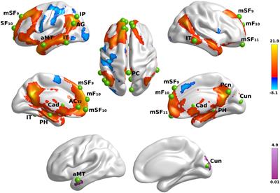 Semantic Recollection in Parkinson’s Disease: Functional Reconfiguration and MAPT Variants